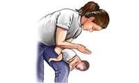 روشهای عملی نجات از خفگی در کودک زیر یک سال 